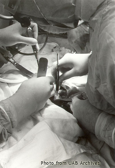 Close-up of surgeons hands in an abdomen